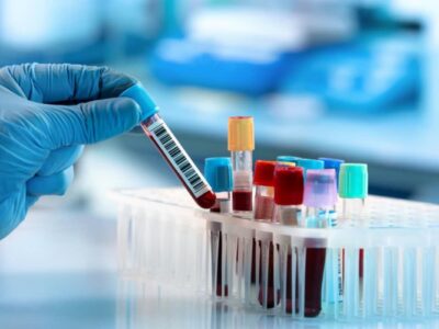 تجهیز آزمایشگاه مرکزی مراغه به دستگاه‌های پیشرفته