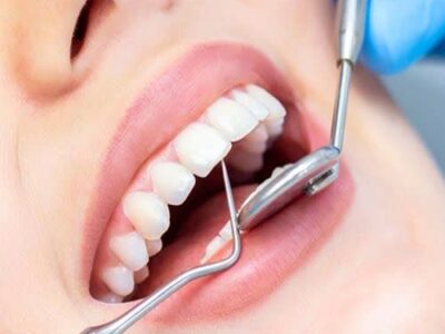 ارائه خدمات رایگان دندانپزشکی به دانش‌آموزان مدرسه ۱۵ خرداد